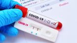 &Pi;&rho;ό&gamma;&rho;&alpha;&mu;&mu;&alpha; Rapid Test &sigma;&tau;&omicron;&nu; &Delta;ή&mu;&omicron; &Beta;έ&rho;&omicron;&iota;&alpha;&sigmaf;