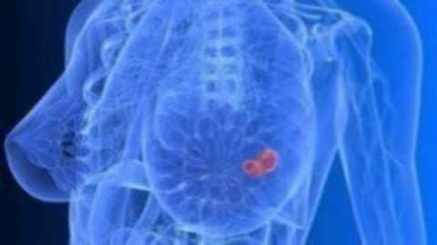 &Epsilon;&nu;&eta;&mu;&epsilon;&rho;&omega;&tau;&iota;&kappa;ή &epsilon;&kappa;&delta;ή&lambda;&omega;&sigma;&eta; &gamma;&iota;&alpha; &tau;&eta;&nu; &pi;&rho;ό&lambda;&eta;&psi;&eta; &tau;&omicron;&upsilon; &kappa;&alpha;&rho;&kappa;ί&nu;&omicron;&upsilon; &tau;&omicron;&upsilon; &mu;&alpha;&sigma;&tau;&omicron;ύ