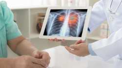 &Omicron; &kappa;&alpha;&rho;&kappa;ί&nu;&omicron;&sigmaf; &tau;&omicron;&upsilon; &pi;&nu;&epsilon;ύ&mu;&omicron;&nu;&alpha; &alpha;&pi;ό &tau;&iota;&sigmaf; &sigma;&upsilon;&chi;&nu;ό&tau;&epsilon;&rho;&epsilon;&sigmaf; &alpha;&iota;&tau;ί&epsilon;&sigmaf; &theta;&alpha;&nu;ά&tau;&omicron;&upsilon; &sigma;&tau;&eta;&nu; &Epsilon;&lambda;&lambda;ά&delta;&alpha; &kappa;&alpha;&iota; &pi;&alpha;&gamma;&kappa;&omicron;&sigma;&mu;ί&omega;&sigmaf;