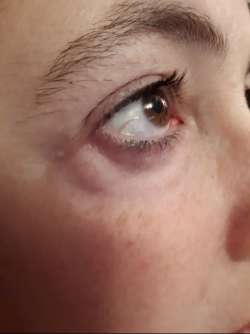 &Delta;&iota;&alpha;&beta;ή&tau;&eta;&sigmaf;: &Tau;&omicron; &sigma;&eta;&mu;ά&delta;&iota; &sigma;&tau;&alpha; &mu;ά&tau;&iota;&alpha; &pi;&omicron;&upsilon; &delta;&epsilon;ί&chi;&nu;&epsilon;&iota; &delta;&iota;&alpha;&beta;&eta;&tau;&iota;&kappa;ή &nu;&epsilon;&phi;&rho;&omicron;&pi;ά&theta;&epsilon;&iota;&alpha;