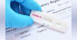 &Epsilon;&beta;&delta;&omicron;&mu;&alpha;&delta;&iota;&alpha;ί&omicron; &pi;&rho;ό&gamma;&rho;&alpha;&mu;&mu;&alpha; &Delta;&omega;&rho;&epsilon;ά&nu; Rapid Test &alpha;&pi;ό 24.05.21 έ&omega;&sigmaf; 30.05.21 &sigma;&epsilon; &pi;&epsilon;&rho;&iota;&omicron;&chi;έ&sigmaf; &tau;&omicron;&upsilon; &Delta;ή&mu;&omicron;&upsilon; &Beta;έ&rho;&omicron;&iota;&alpha;&sigmaf;