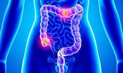 &Delta;έ&kappa;&alpha; &epsilon;&rho;&omega;&tau;ή&sigma;&epsilon;&iota;&sigmaf; &kappa;&alpha;&iota; &alpha;&pi;&alpha;&nu;&tau;ή&sigma;&epsilon;&iota;&sigmaf; &gamma;&iota;&alpha; &tau;&omicron;&nu; &kappa;&alpha;&rho;&kappa;ί&nu;&omicron; &tau;&omicron;&upsilon; &pi;&alpha;&chi;έ&omicron;&sigmaf; &epsilon;&nu;&tau;έ&rho;&omicron;&upsilon; &kappa;&alpha;&iota; &tau;&omicron;&nu; &pi;&rho;&omicron;&sigma;&upsilon;&mu;&pi;&tau;&omega;&mu;&alpha;&tau;&iota;&kappa;ό έ&lambda;&epsilon;&gamma;&chi;&omicron;