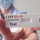 Rapid Test &sigma;&tau;&eta;&nu; &Kappa;&omicron;&iota;&nu;ό&tau;&eta;&tau;&alpha; &Alpha;&gamma;ί&omicron;&upsilon; &Gamma;&epsilon;&omega;&rho;&gamma;ί&omicron;&upsilon; &Delta;ή&mu;&omicron;&upsilon; &Beta;έ&rho;&omicron;&iota;&alpha;&sigmaf;