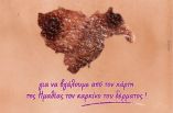 &Pi;.&Epsilon;. &Eta;&mu;&alpha;&theta;ί&alpha;&sigmaf; &gamma;&iota;&alpha; &tau;&eta;&nu; &eta;&mu;&epsilon;&rho;ί&delta;&alpha; &mu;&epsilon; &theta;έ&mu;&alpha; &tau;&omicron;&nu; &Kappa;&alpha;&rho;&kappa;ί&nu;&omicron; &tau;&omicron;&upsilon; &delta;έ&rho;&mu;&alpha;&tau;&omicron;&sigmaf;