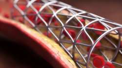 &Upsilon;&gamma;&epsilon;ί&alpha;: &Chi;&rho;ή&sigma;&eta; &pi;&rho;&omicron;&lambda;&eta;&pi;&tau;&iota;&kappa;&omicron;ύ &sigma;&tau;&epsilon;&nu;&tau; &gamma;&iota;&alpha; &tau;&eta;&nu; &pi;&rho;ό&beta;&lambda;&epsilon;&psi;&eta; &epsilon;&mu;&phi;&rho;&alpha;&gamma;&mu;ά&tau;&omega;&nu; &kappa;&alpha;&iota; &alpha;&iota;&phi;&nu;ί&delta;&iota;&omega;&nu; &theta;&alpha;&nu;ά&tau;&omega;&nu;